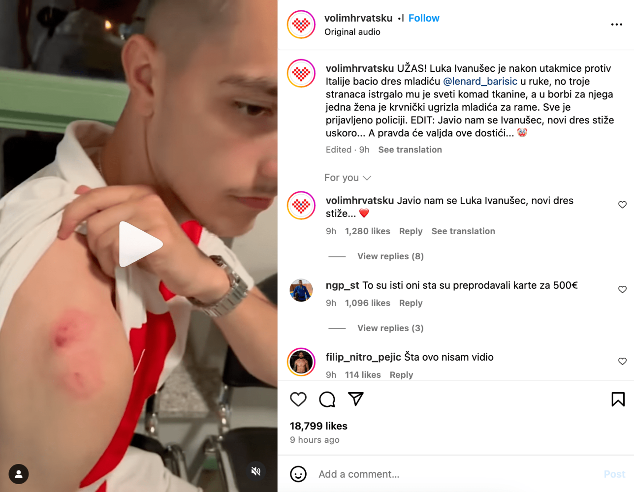 Kibic Chorwacji Ugryziony